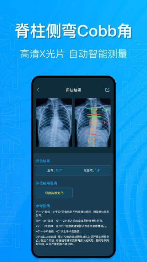 体态评估大师app 1